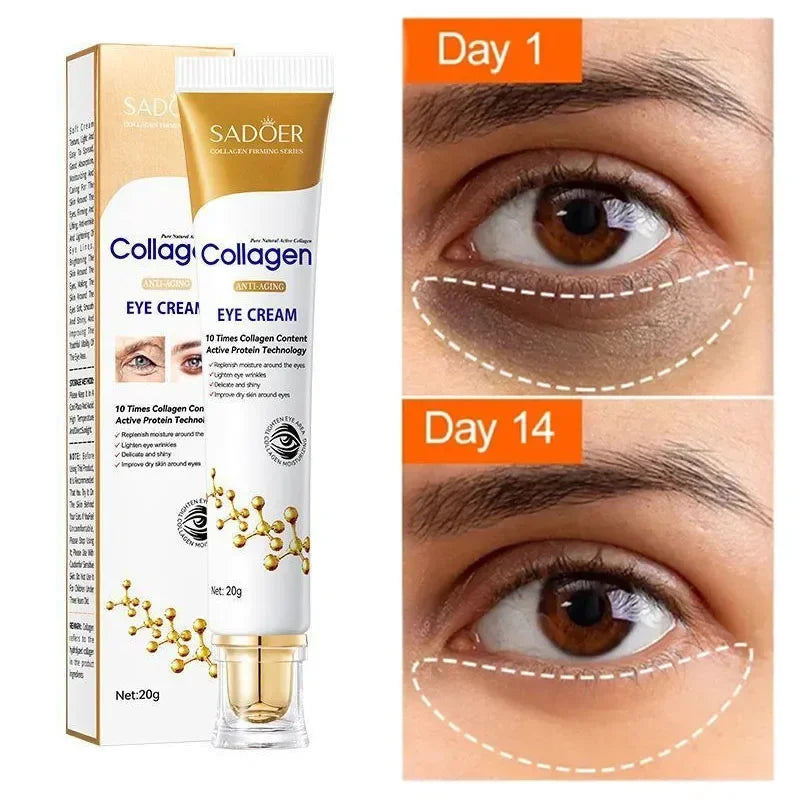 Sadoer collagen anti-aging eye cream tube and box showing visible dark circle reduction from day 1 to day 14