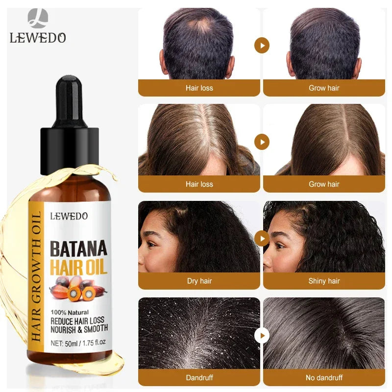 Batana Hair Oil bottle with before and after images showing hair loss, dry hair, dandruff improvements