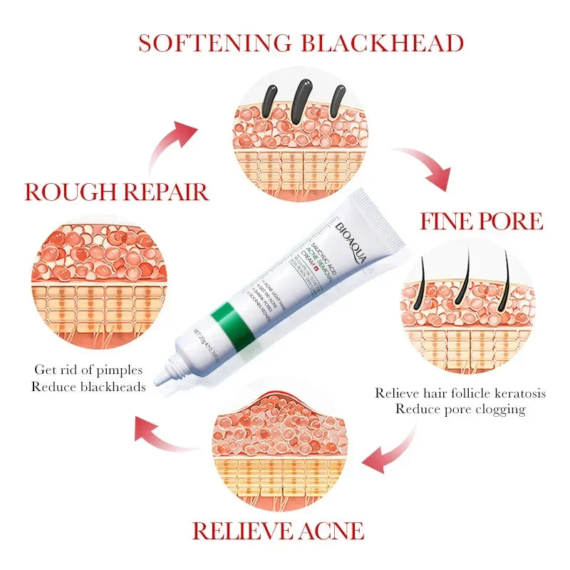 Bioaqua acne repair cream with skin diagrams showing blackhead softening, pore refining, acne relief, and skin repair