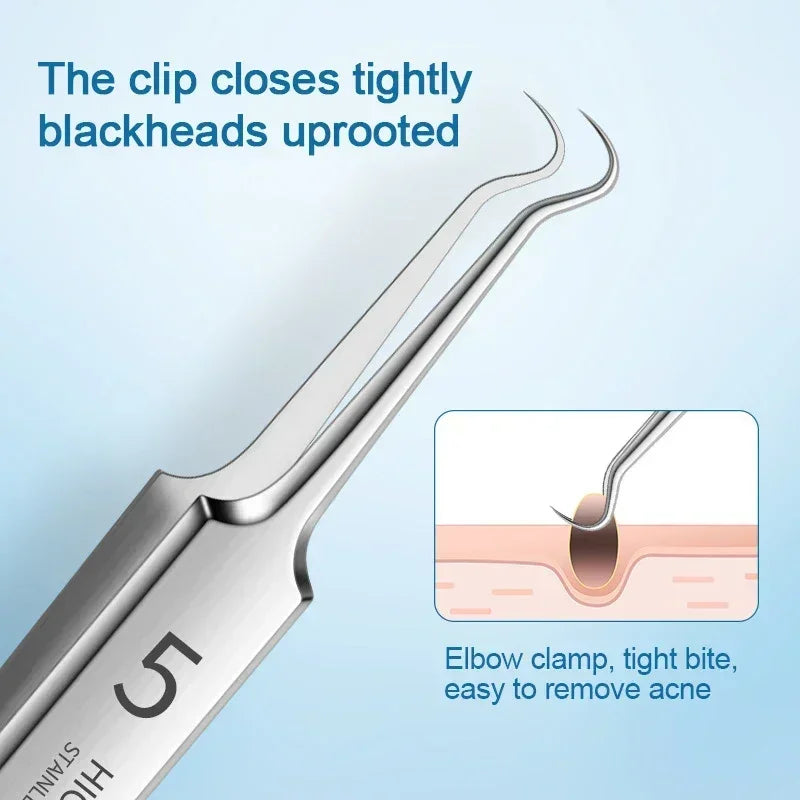 Stainless steel blackhead removal tool with tight clip for uprooting blackheads and acne extraction