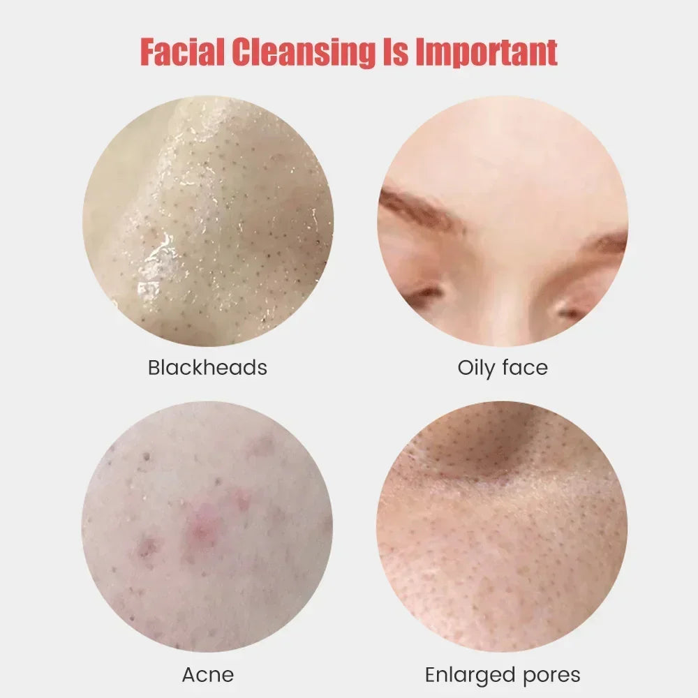 Close-up images showing blackheads, oily face, acne, and enlarged pores highlighting facial cleansing importance