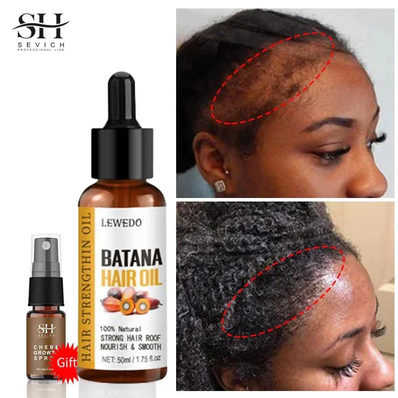 Before and after images showing improved hair growth on women's scalp using Lewedo Batana Hair Oil and Chebe Growth Spray