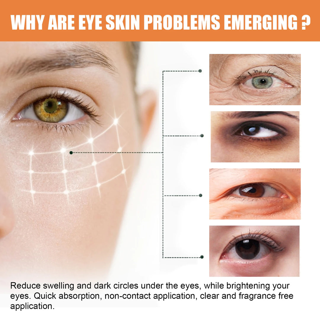 Close-up of eye skin problems like wrinkles, dark circles, puffiness, and redness with treatment benefits