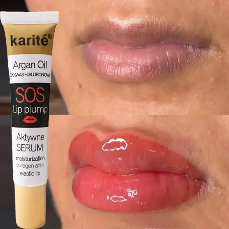 Before and after lips using Karite SOS Lip Plump serum with argan oil for moisturization and collagen activation