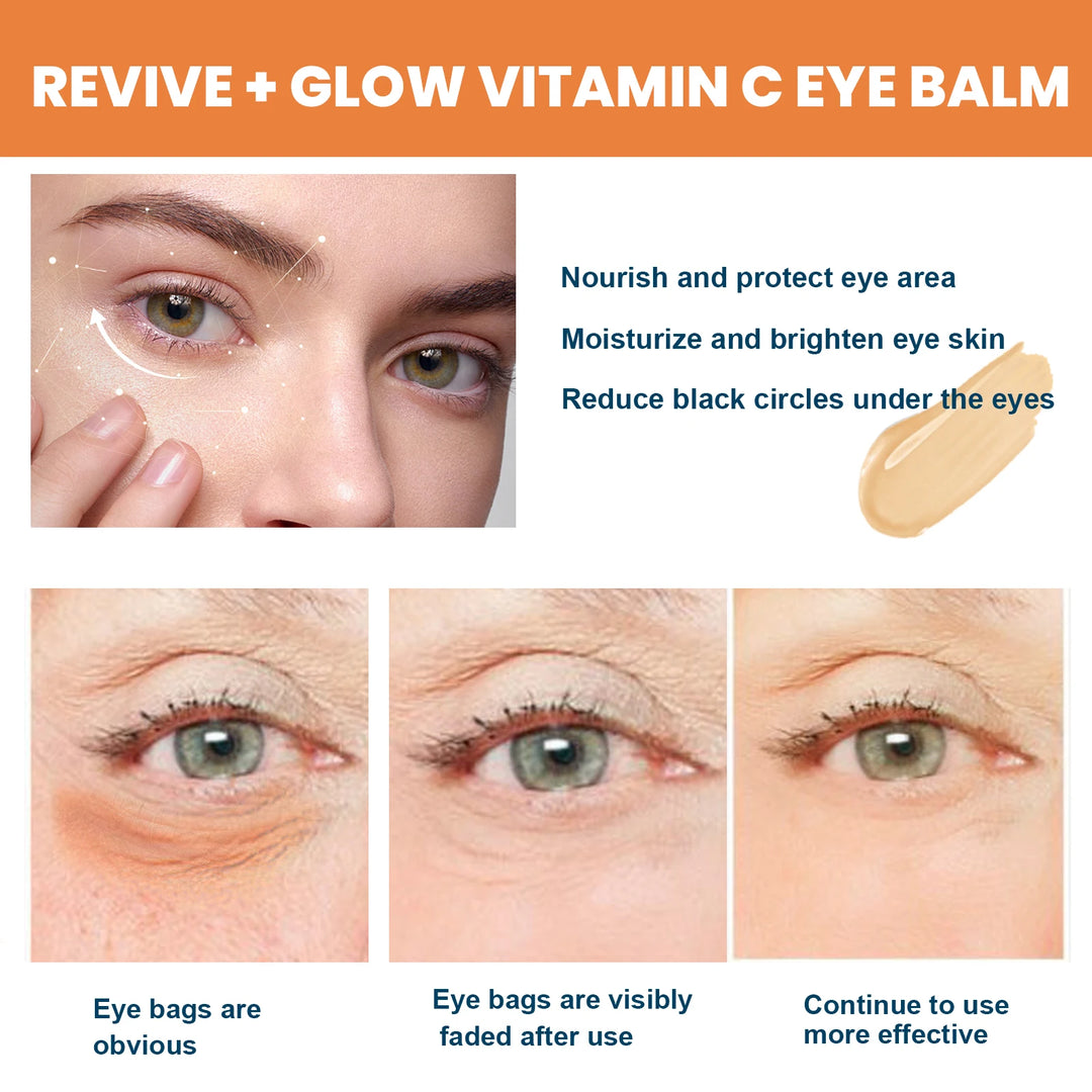 Close-up of eyes showing Vitamin C eye balm benefits reducing eye bags, brightening, and moisturizing skin