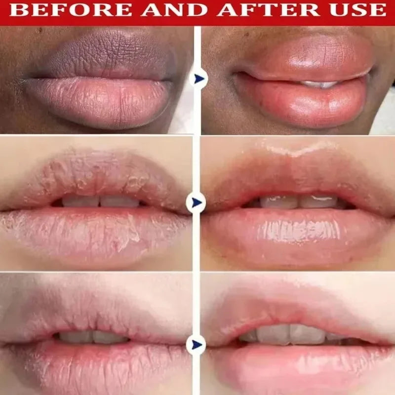 Before and after use comparison of lips showing improved hydration and reduced dryness