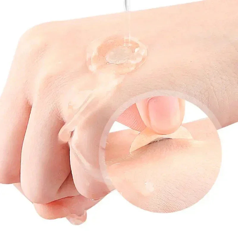 hand with transparent hydrocolloid acne patch and close-up of patch peeling off skin