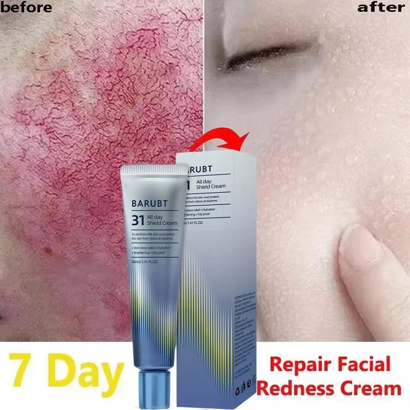 Before and after images showing reduced facial redness after 7 days using Barubt 31 All Day Shield Cream