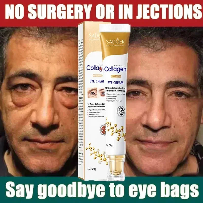 Before and after photos of man showing reduced eye bags using Sadoer collagen anti-aging eye cream