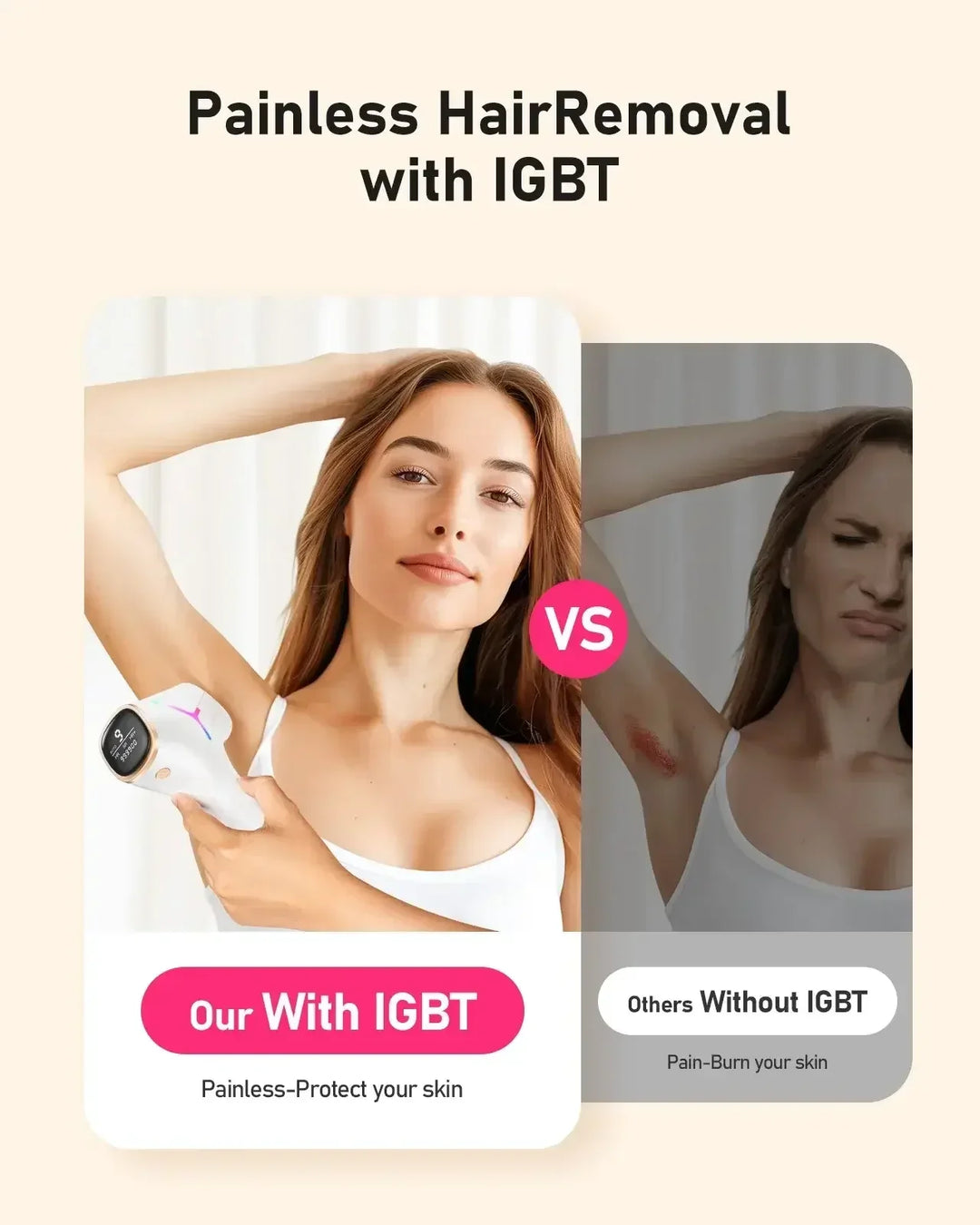 Comparison of painless hair removal with IGBT device versus painful skin burning without IGBT