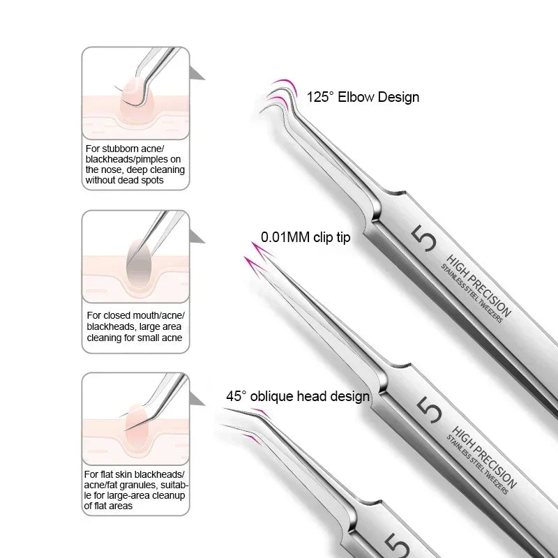 High precision stainless steel tweezers with 125° elbow and 45° oblique head for acne and blackhead removal