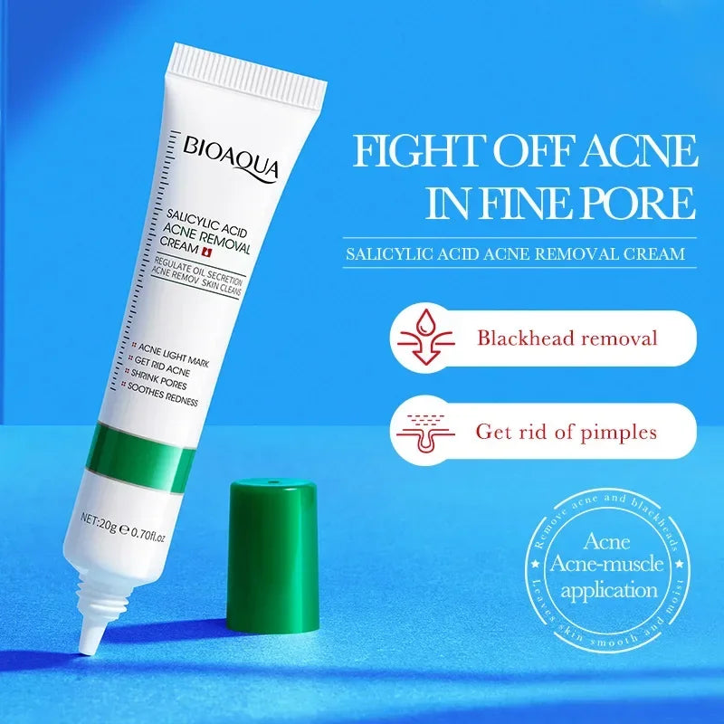 Bioaqua salicylic acid acne removal cream tube with green cap on blue background highlighting blackhead and pimple removal